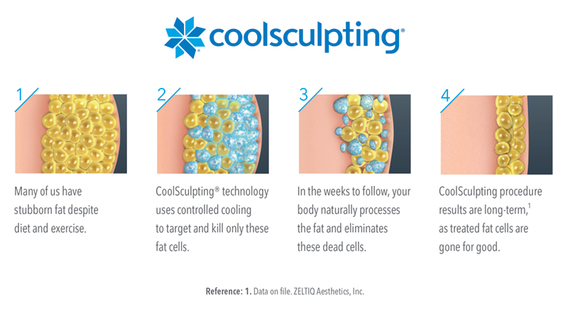Coolsculpting-animated-image-horizontal Coolsculpting-animated-image-horizontal